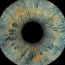 Фото радужки глаз на выезд