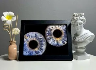 Парное фото радужки глаз в Балашихе