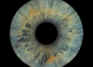 Фото радужки глаз на выезд