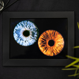 Парное фото радужки глаза