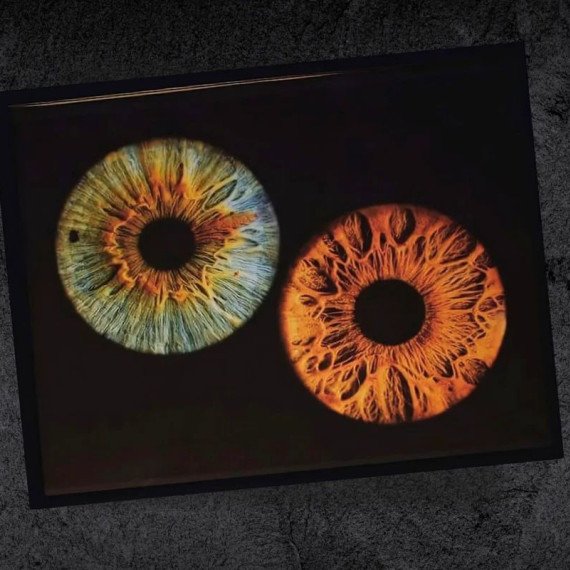 Изображение двух радужек разного цвета на черном фоне в лабораторных условиях. Главное фото