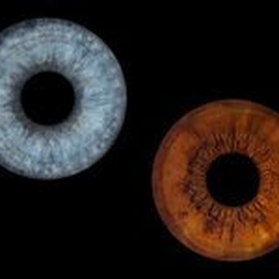 Фотография радужки глаза в электронном виде - изображение 3